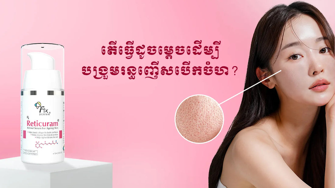 How to minimize open pores?