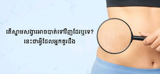 តើស្នាមសង្វារអាចបាត់ទៅវិញដែរឬទេ? នេះជាអ្វីដែលអ្នកគួរដឹង