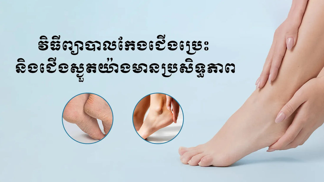 វិធីព្យាបាលកែងជើងប្រេះ និងជើងស្ងួតយ៉ាងមានប្រសិទ្ធភាព