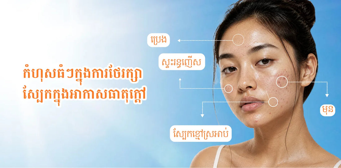កំហុសធំៗក្នុងការថែរក្សាស្បែកក្នុងអាកាសធាតុក្តៅ