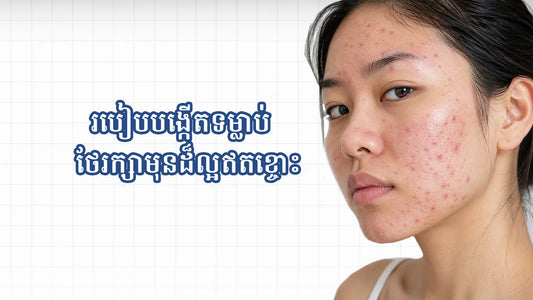 របៀបបង្កើតទម្លាប់ថែរក្សាមុនដ៏ល្អឥតខ្ចោ